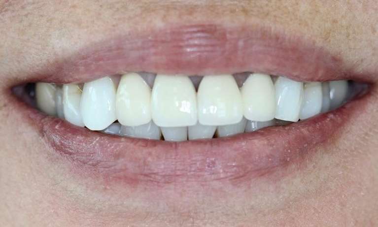 The-Smile-of-Her-Dreams-Before-Image